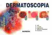 DERMATOSCOPIA. PAUTAS DE DIAGNOSTICO