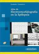 ATLAS DE ELECTROENCEFALOGRAFIA EN LA EPILEPSIA