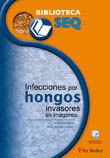 INFECCIONES POR HONGOS INVASORES EN IMAGENES