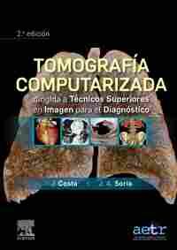 TOMOGRAFIA COMPUTARIZADA DIRIGIDA A TÉCNICOS SUPERIORES EN IMAGEN PARA EL DIAGNÓSTICO