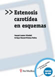 ESTENOSIS CAROTÍDEA EN ESQUEMAS