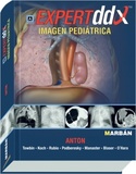EXPERTDDX. IMAGEN PEDIATRICA