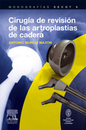 CIRUGIA DE REVISION DE LAS ARTROPLASTIAS DE CADERA