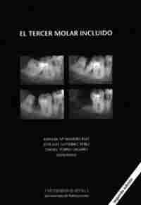 (2ª) EL TERCER MOLAR INCLUIDO