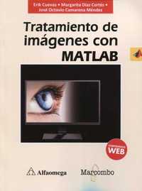 TRATAMIENTO DE IMÁGENES CON MATLAB.