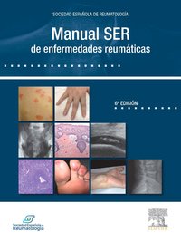 MANUAL SER DE ENFERMEDADES REUMATICAS