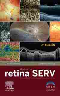(2ª) MANUAL DE RETINA SERV