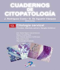 13. CUADERNOS DE CITOPATOLOGIA: CITOLOGIA CERVICAL