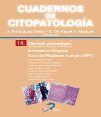 14.CUADERNOS DE CITOPATOLOGIA: CITOLOGIA GINECOLOGICA