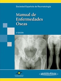 (2º) MANUAL DE ENFERMEDADES OSEAS