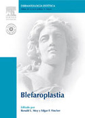 BLEFAROPLASTIA