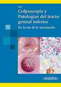COLPOSCOPIA Y PATOLOGIAS DEL TRACTO GENITAL INFERIOR
