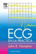 (4º) ECG EN LA PRACTICA
