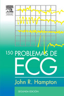 (2º) 150 PROBLEMAS DE ECG