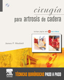 CIRUGIA PARA ARTROSIS DE CADERA