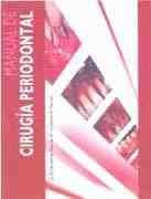 MANUAL DE CIRUGIA PERIODONTAL