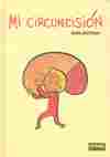MI CIRCUNCISION
