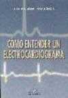 COMO ENTENDER UN ELECTROCARDIOGRAMA
