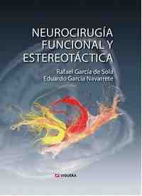 NEUROCIRUGIA FUNCIONAL Y ESTEREOTACTICA