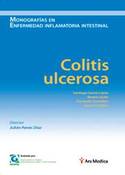 COLITIS ULCEROSA
