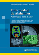ENFERMEDAD DE ALZHEIMER