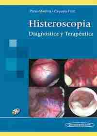 HISTEROSCOPIA: DIAGNOSTICA Y TERAPEUTICA